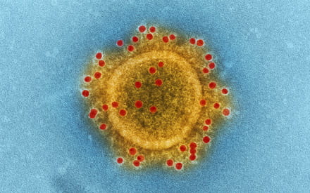 Coronavirus : comment fabriquer son gel hydroalcoolique ?