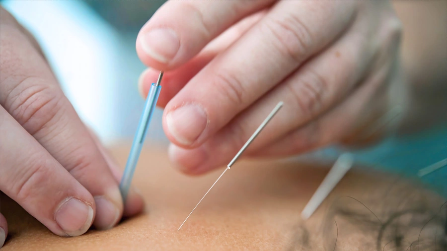 Acupuncture et médecine douce en Suisse romande